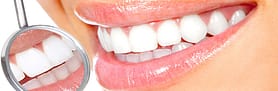 white teeth
